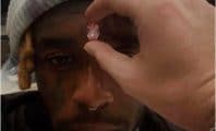 Lil Uzi Vert s'implante un diamant rose de 24 millions de dollars dans son front